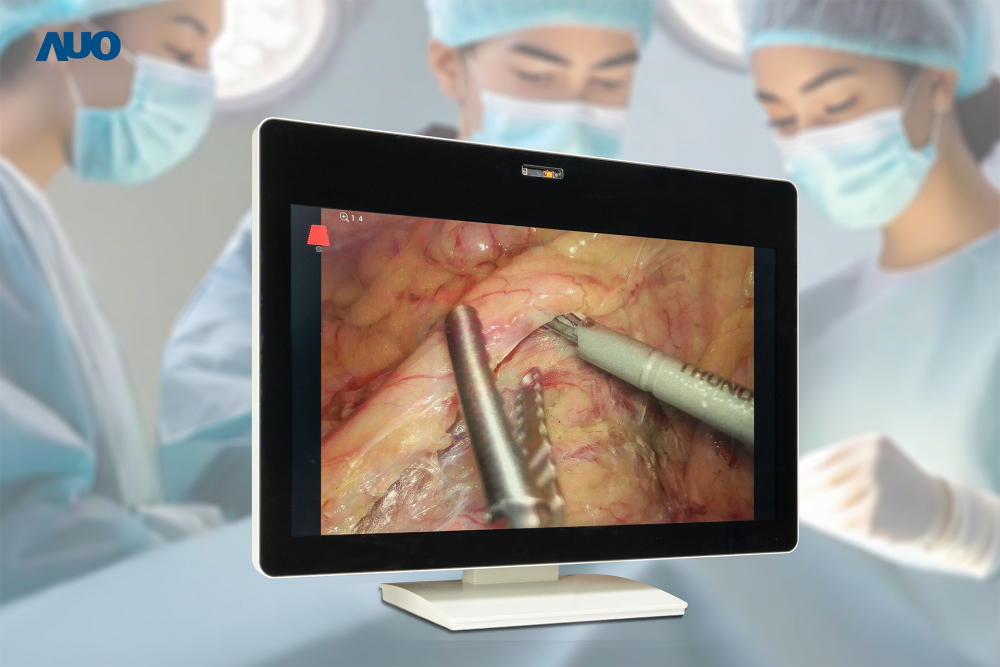 熊猫体育「中国」佈局智慧醫療場域，開發裸眼3D醫療顯示器，協助醫療團隊在手術過程中無需佩戴3D眼鏡，即能清晰觀看3D影像，同時提升手術溝通效率及舒適感  